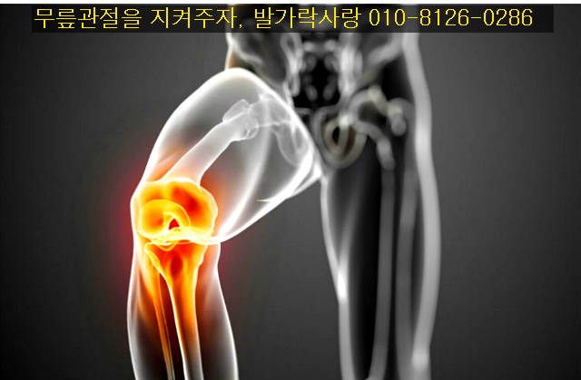 무릎관절을 지켜주자