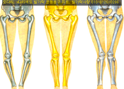 무릎관절을 지켜주자